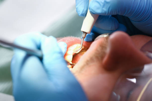 Best Walk-In Emergency Dentist in Clarksville, TN